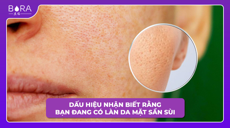 Dấu hiệu nhận biết rằng bạn đang có làn da mặt sần sùi 